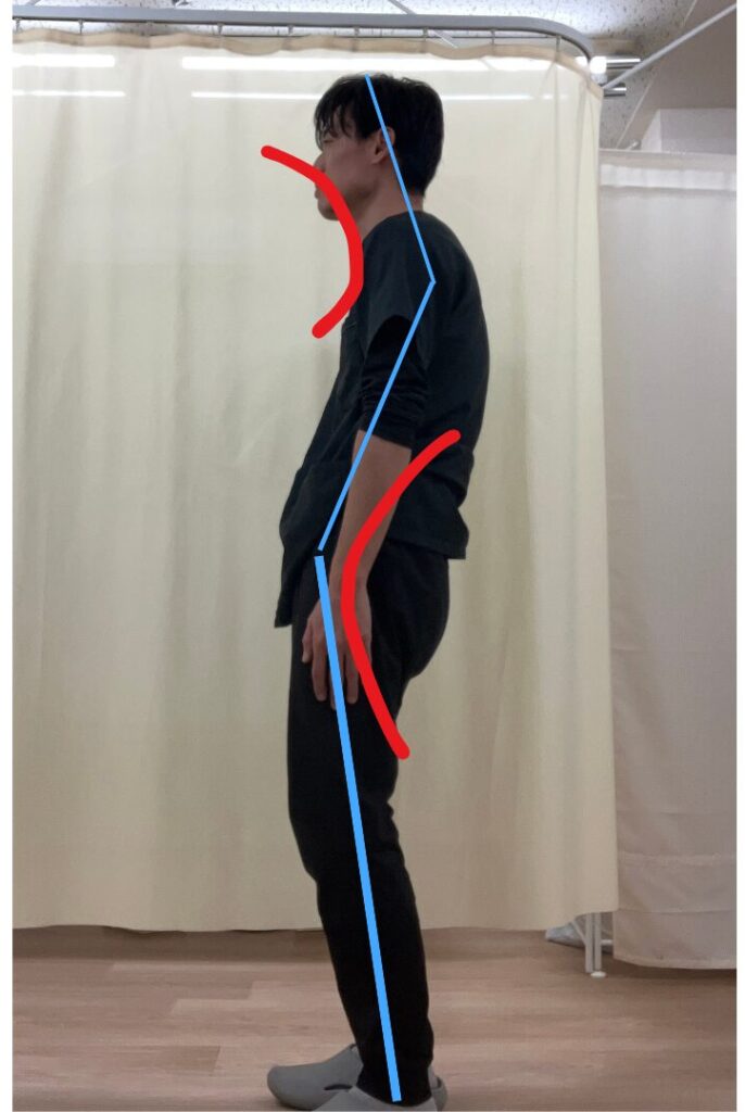 スウェイバック(強め)
「スウェイバック姿勢|骨盤前方移動と上半身後傾の例」