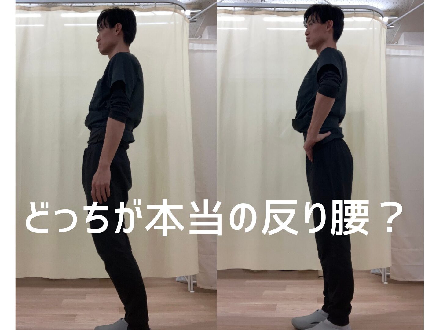 「本当の反り腰と見せかけの反り腰（スウェイバック）の比較写真」